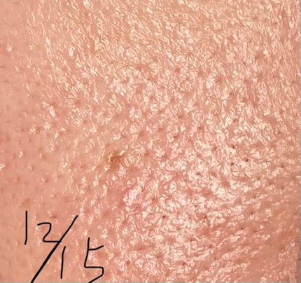 ガラクナイアシン2.0エッセンス/manyo/美容液を使ったクチコミ(7枚目)