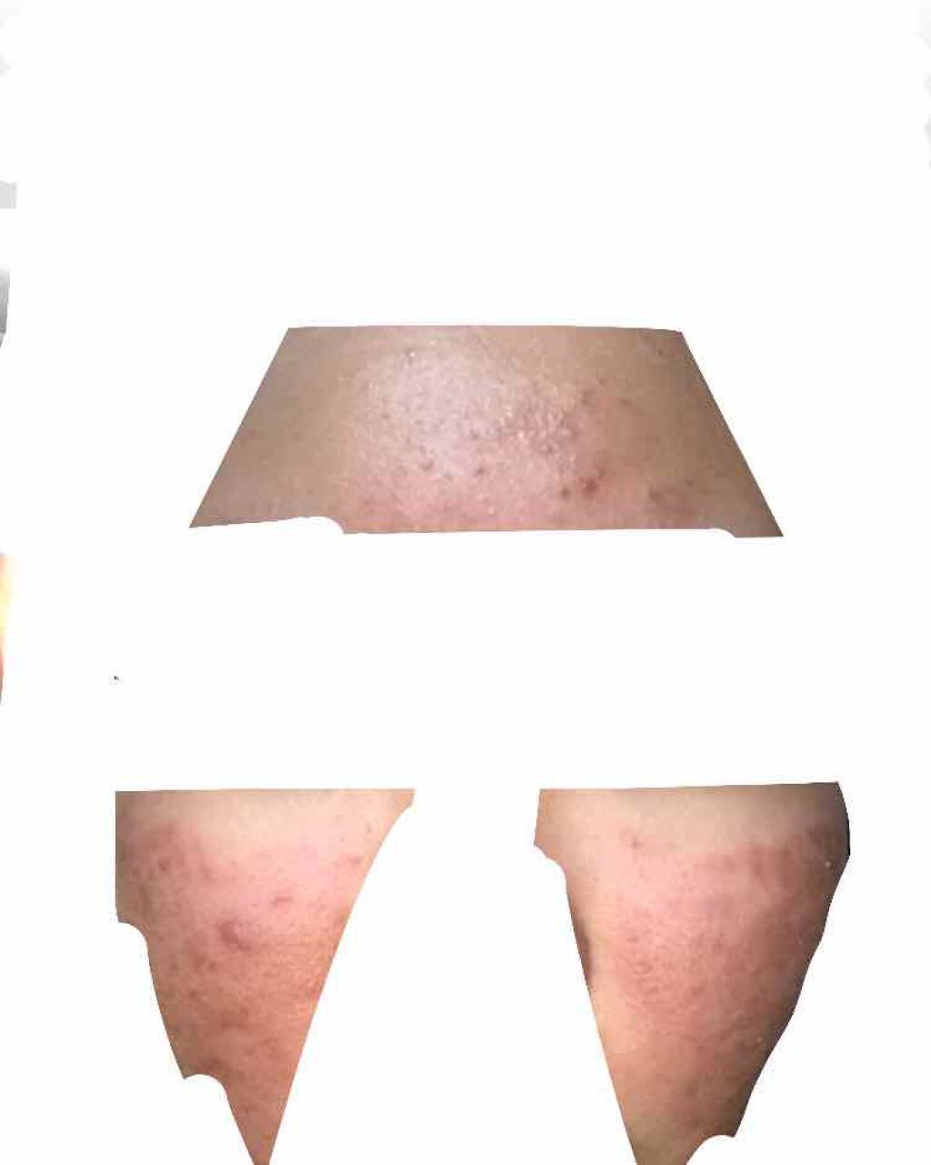 ぴ on LIPS 「⚠️4枚目汚肌注意❗️❗️こんにちは!ぴです。先週?先々週?く..」(4枚目)