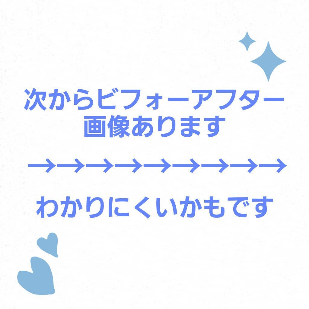 フラワーティントリップ/JellyKiss/リップティントを使ったクチコミ(3枚目)