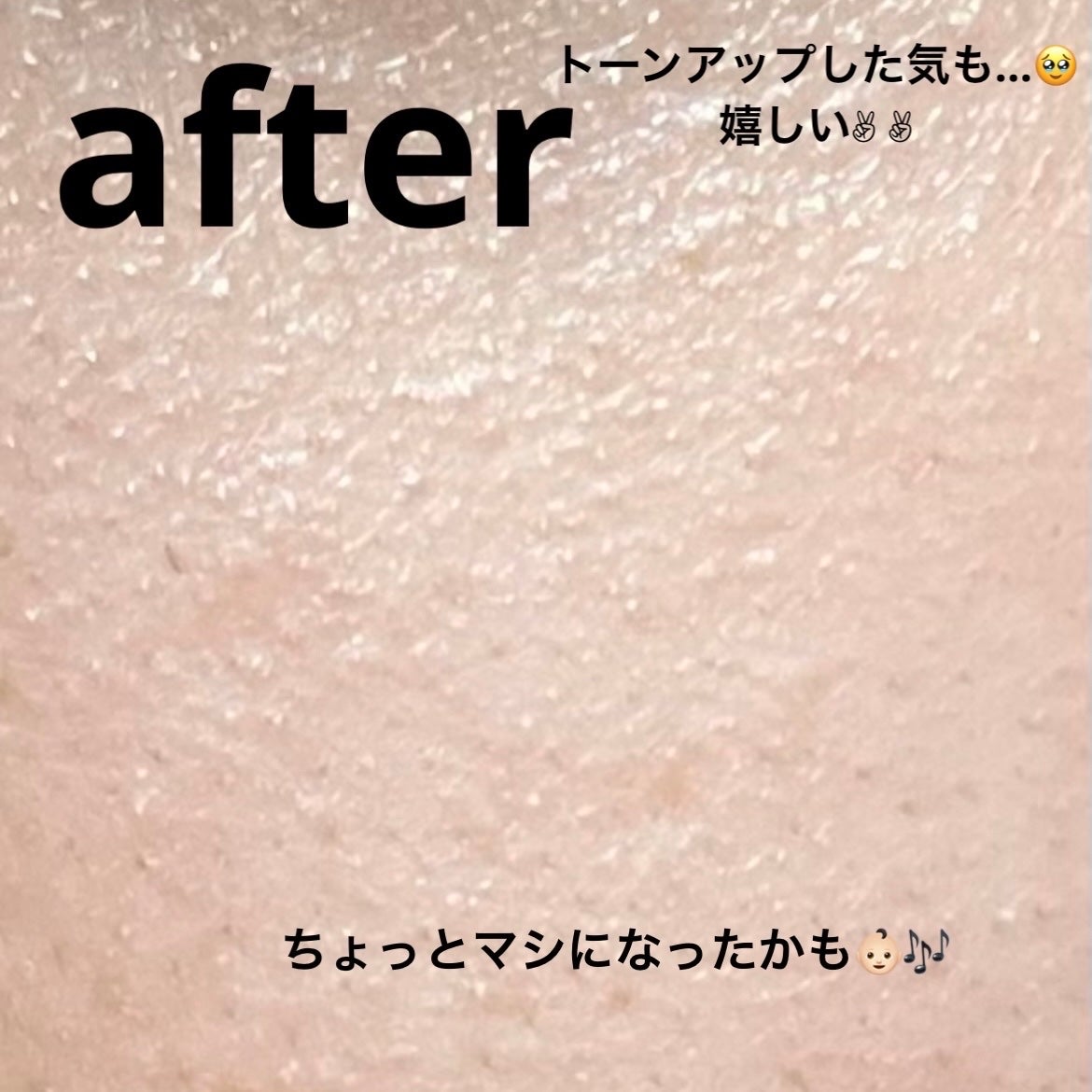 THE シカ 365 バランシングマスク/MEDIHEAL/シートマスク・パックを使ったクチコミ(5枚目)