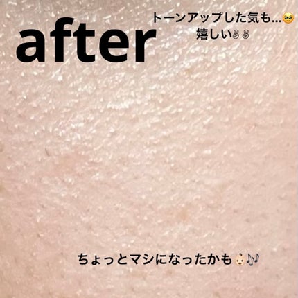 THE シカ 365 バランシングマスク/MEDIHEAL/シートマスク・パックを使ったクチコミ(5枚目)