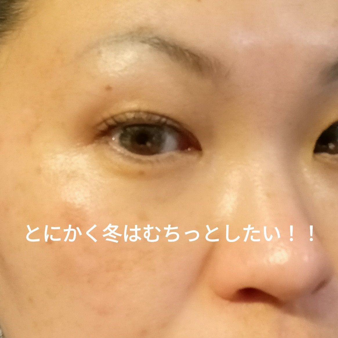 5GF リフティナル ターンオーバー 美容液/Mildlab/美容液を使ったクチコミ(6枚目)