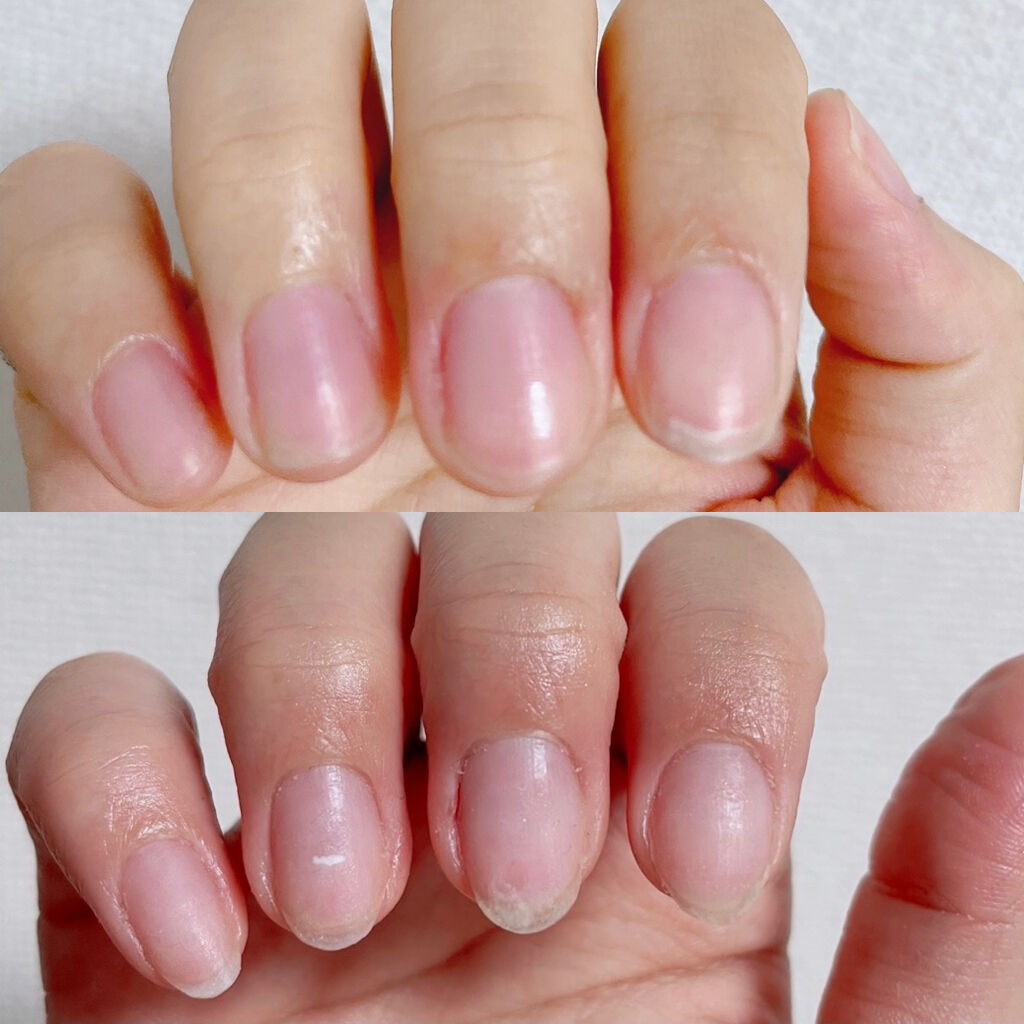 デイケアオイル Dr Nailの口コミ 爪の縦線亀裂で悩んでいる方へ 是非ご覧くだ By R E N A𓂃𓈒𓏸 混合肌 代後半 Lips