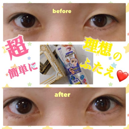 ワンダーアイリッドテープ Extra/D-UP/二重まぶた用アイテムを使ったクチコミ(1枚目)