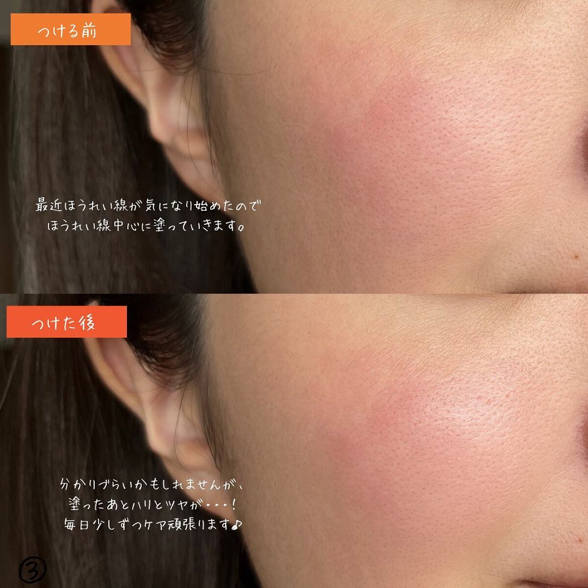 ベラコントゥアーフォーミングクリーム/ANACIS/フェイスクリームを使ったクチコミ(4枚目)