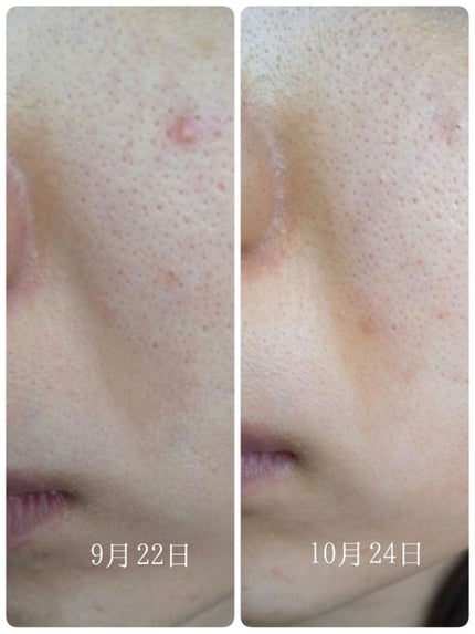 Cサスペンション23+HAスフィア2フェイスクリーム/The Ordinary/美容液を使ったクチコミ(2枚目)