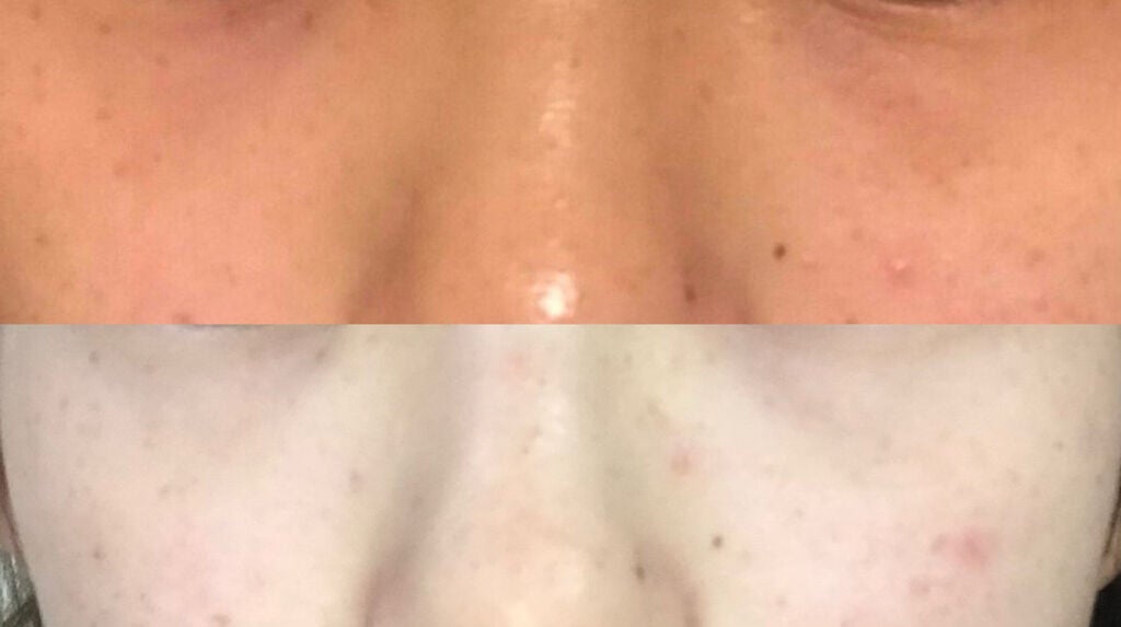 ハイドロクリームPHQ-8/KISO/美容液を使ったクチコミ(3枚目)