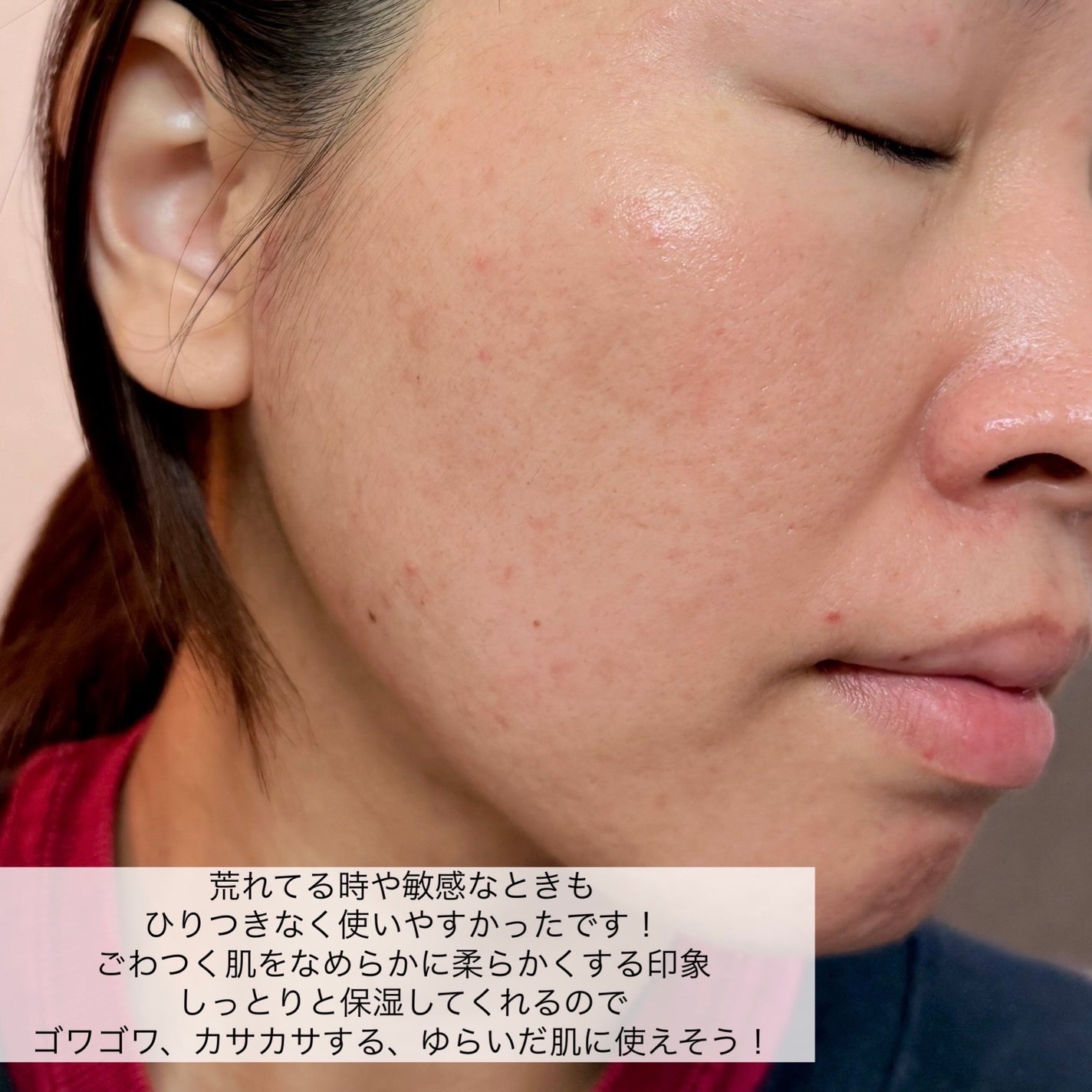 マデカ トーニング エッセンス トリートメント/センテリアン24/化粧水を使ったクチコミ(7枚目)