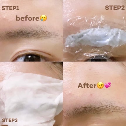 脱色クリーム 敏感肌用 脱色クリーム(敏感肌用)【旧】/エピラット/ムダ毛ケアを使ったクチコミ(2枚目)