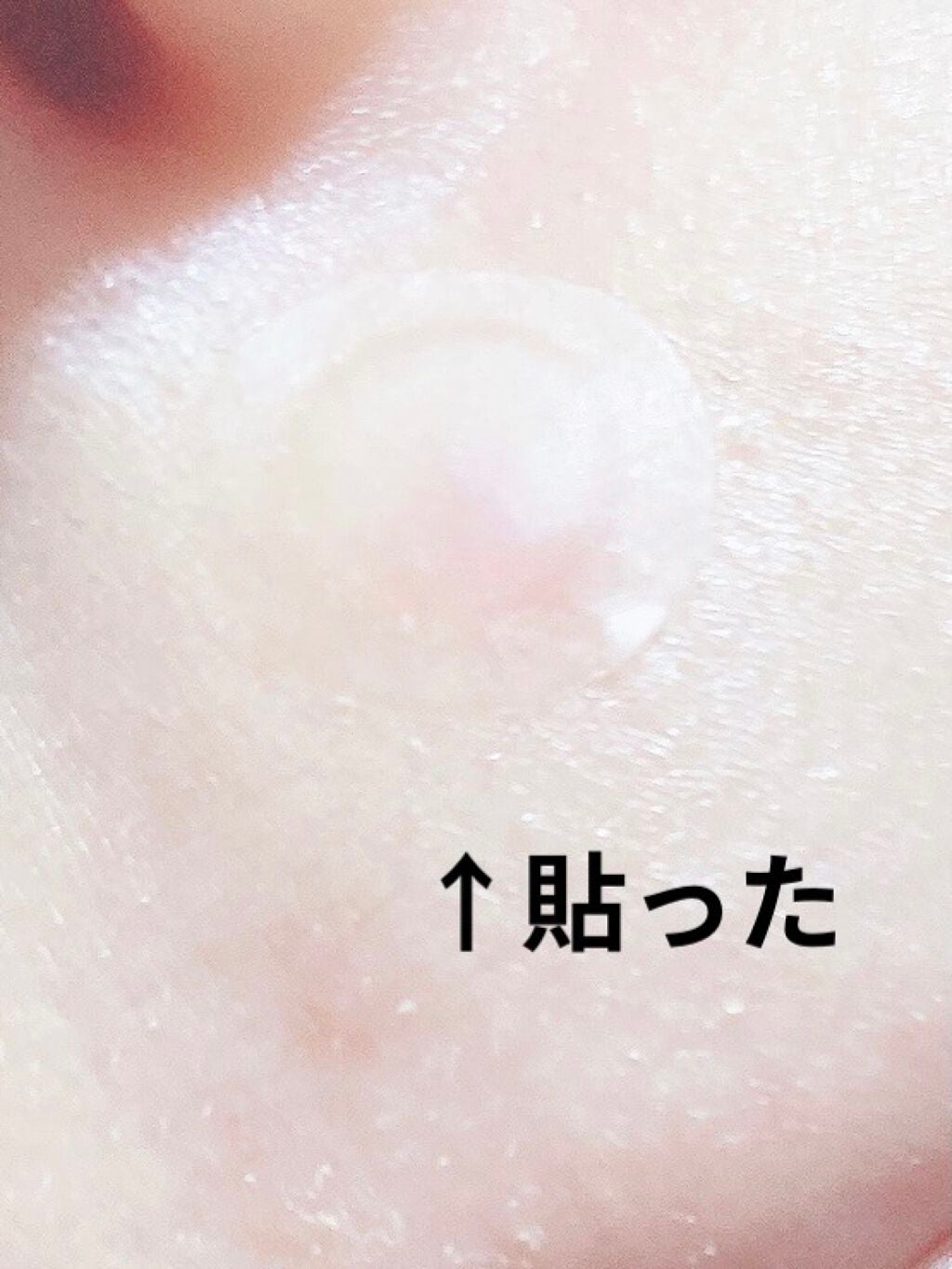 あげぱん on LIPS 「こんばんは!OKクリアパッチ<コンシーラーパッチ>を使用させて..」(7枚目)