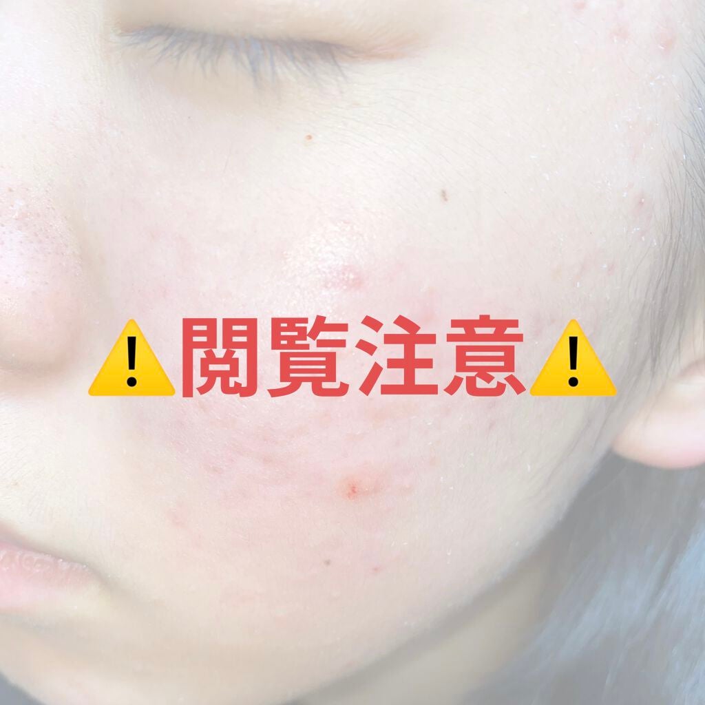 薬用保湿化粧水/オードムーゲ/化粧水を使ったクチコミ(1枚目)