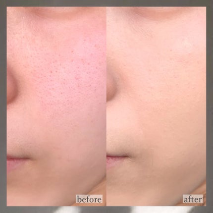 ピンクティーツリーカバークッション/APLIN/クッションファンデーションを使ったクチコミ(5枚目)