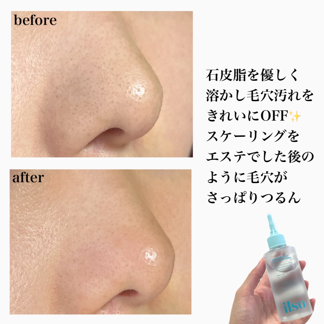 ILSO　スーパーメルティング セバムソフトナー/ilso/化粧水を使ったクチコミ（2枚目）