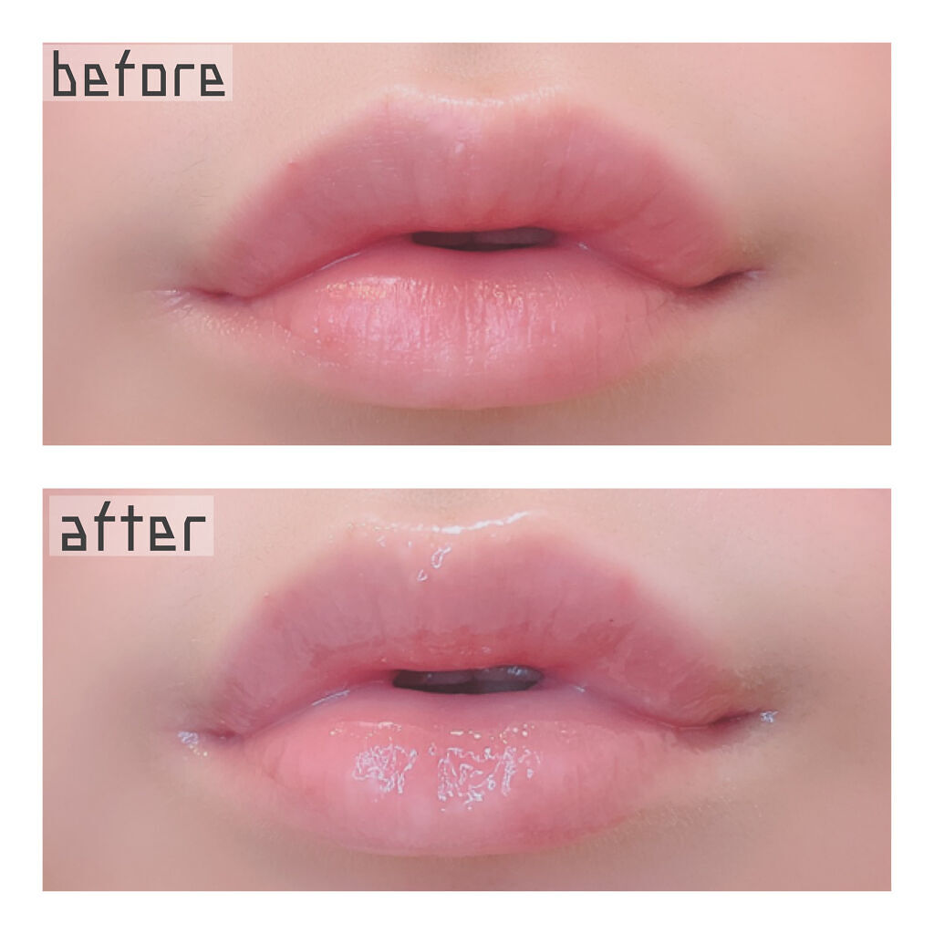  リップセラム プレミア /ceruru.b/リップ美容液を使ったクチコミ（3枚目）