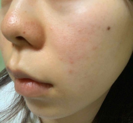 を使ったクチコミ(1枚目)