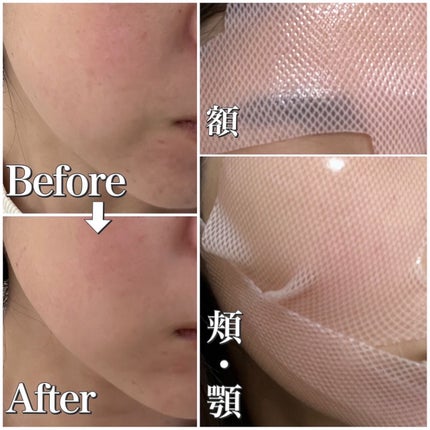 インモトックステンションアップマスク/MEDITHERAPY/シートマスク・パックを使ったクチコミ(4枚目)