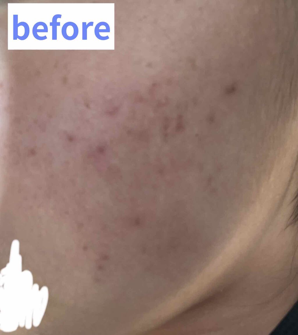 DHC マルチビタミン/DHC/美容サプリメントを使ったクチコミ(2枚目)