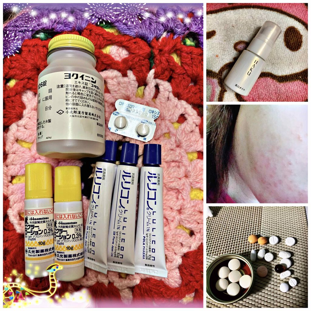 アクアチムローション、アクアチムクリーム(医薬品)/大塚製薬/その他を使ったクチコミ（2枚目）