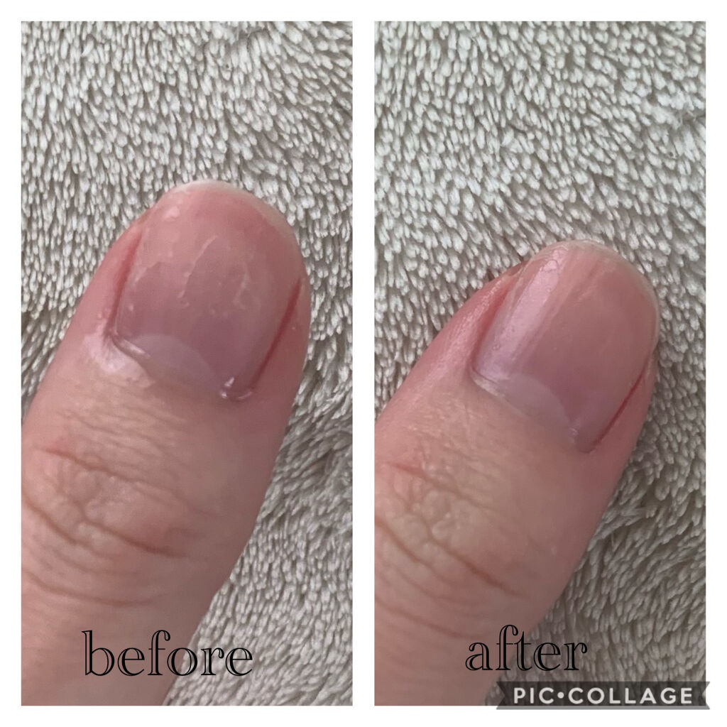 デイケアオイル/Dr.Nail/ネイルオイル・トリートメントを使ったクチコミ（2枚目）