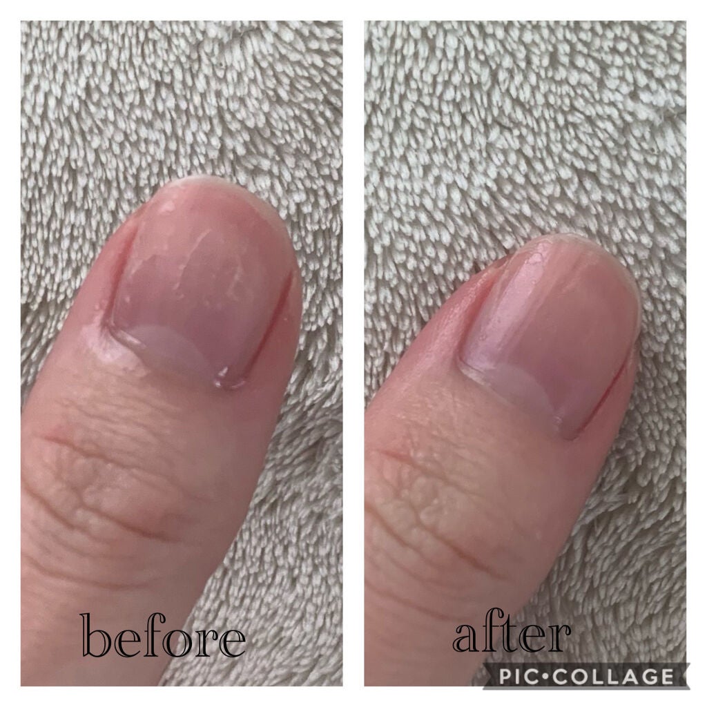 デイケアオイル/Dr.Nail/ネイルオイル・トリートメントを使ったクチコミ(2枚目)