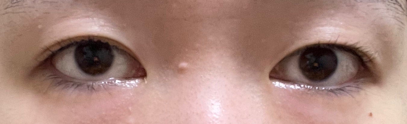 メッシュ アイテープ/shefun/二重まぶた用アイテムを使ったクチコミ(3枚目)