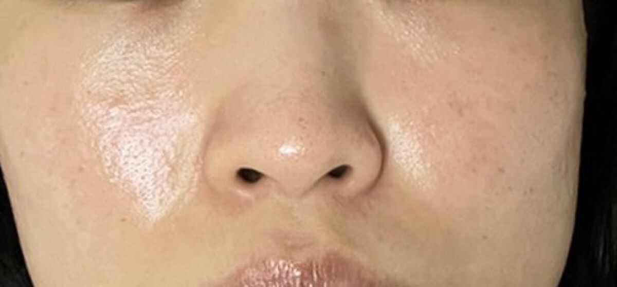 ドクダミ 77 スージングトナー/Anua/化粧水を使ったクチコミ（3枚目）