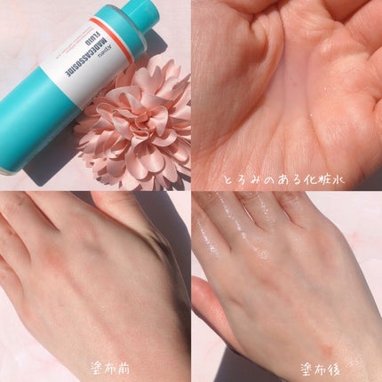 マデカソ CICA化粧水/A’pieu/化粧水を使ったクチコミ(2枚目)