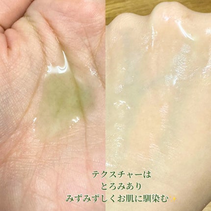 アゼライン酸15 インテンスカーミングセラム/Anua/美容液を使ったクチコミ(3枚目)