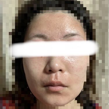 試してみた キンダベート軟膏0 05 医薬品 グラクソ スミスクライン コンシューマー ヘルスケア ジャパン Lips