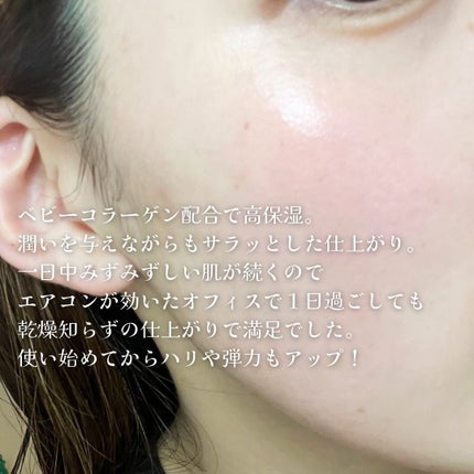 CLセラム/XOUL/美容液を使ったクチコミ(3枚目)