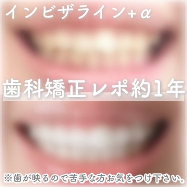 ナイトミン 鼻呼吸テープ/小林製薬/その他を使ったクチコミ（1枚目）