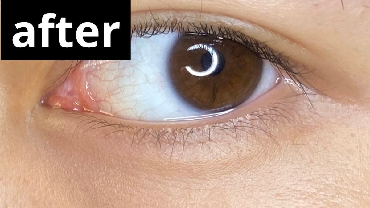 リシェ レッドトリック アイコンシーラー/Visée/パレットコンシーラーを使ったクチコミ(5枚目)