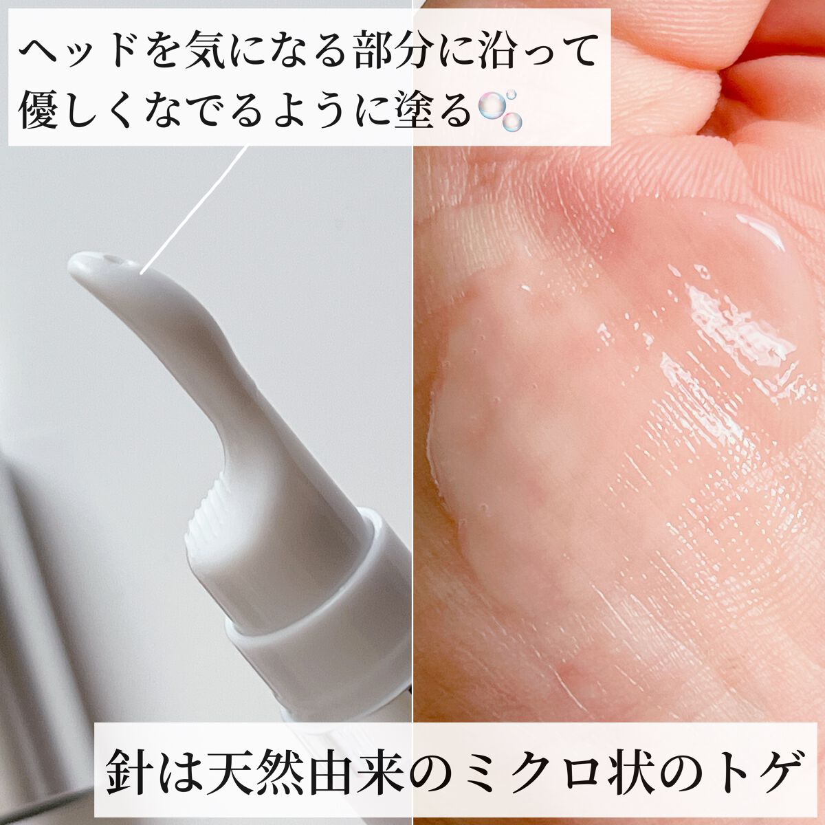 lujo ニードルセラム/lujo/美容液を使ったクチコミ（3枚目）