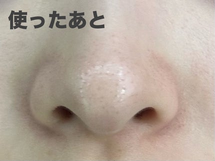 ノーモアブラックヘッド(ノーズピーリング)/One-day's you/スクラブ・ゴマージュを使ったクチコミ(5枚目)