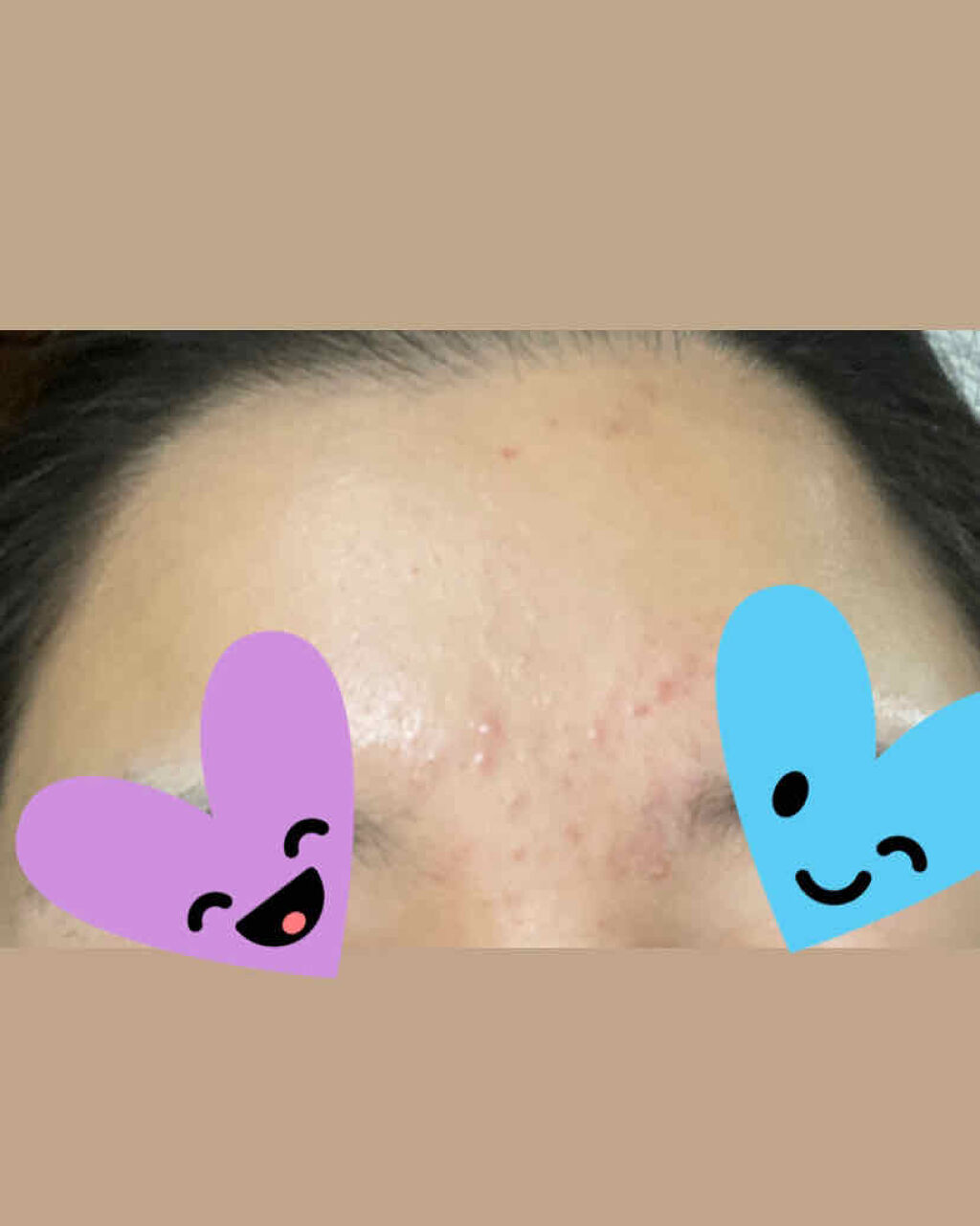 アルビオン 薬用スキンコンディショナー エッセンシャル 165ml/ALBION/化粧水を使ったクチコミ（2枚目）