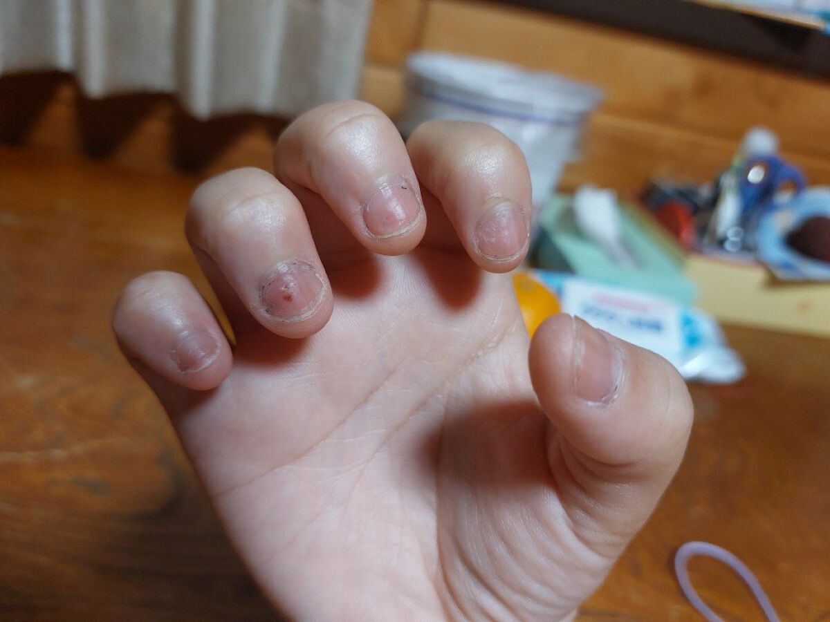 を使ったクチコミ（2枚目）