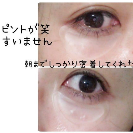 メディリフト 3Dマイクロフィラー(口元用)/YA-MAN TOKYO JAPAN/シートマスク・パックを使ったクチコミ(2枚目)