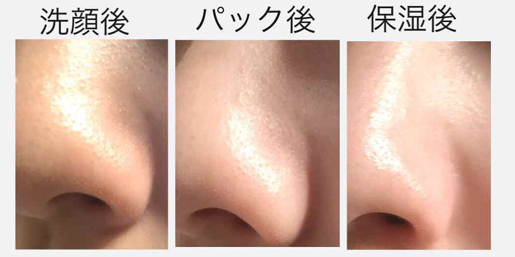 毛穴パックを使うのはだめ 後悔せずに角栓をごっそり取る方法 おすすめ人気ランキングtop10 メンズ 韓国 Lips