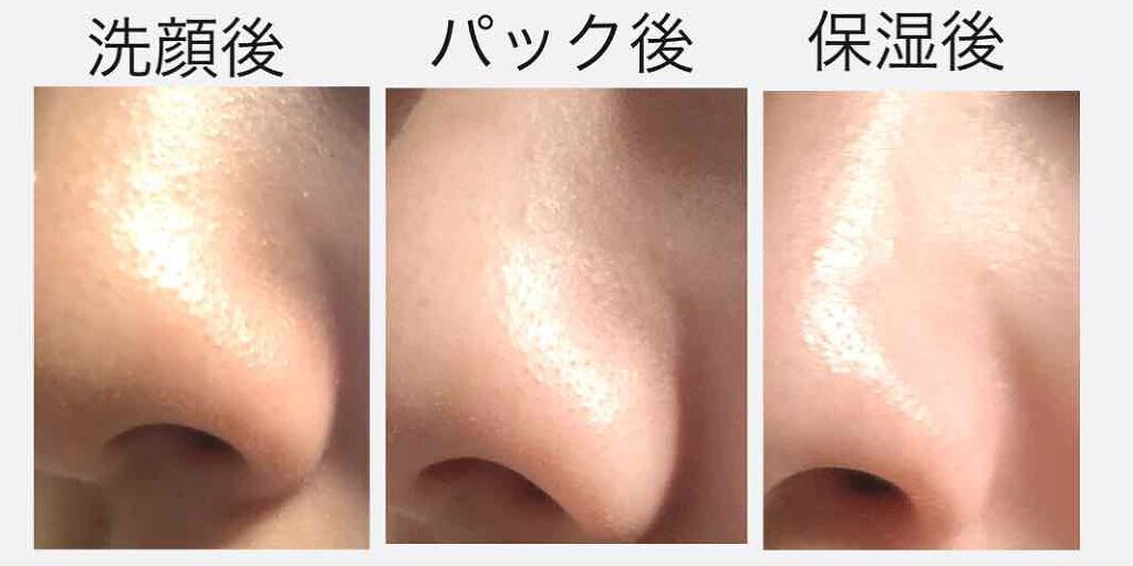 毛穴パックを使うのはだめ?後悔しない使い方を解説【おすすめ毛穴パックのランキング11選】のサムネイル