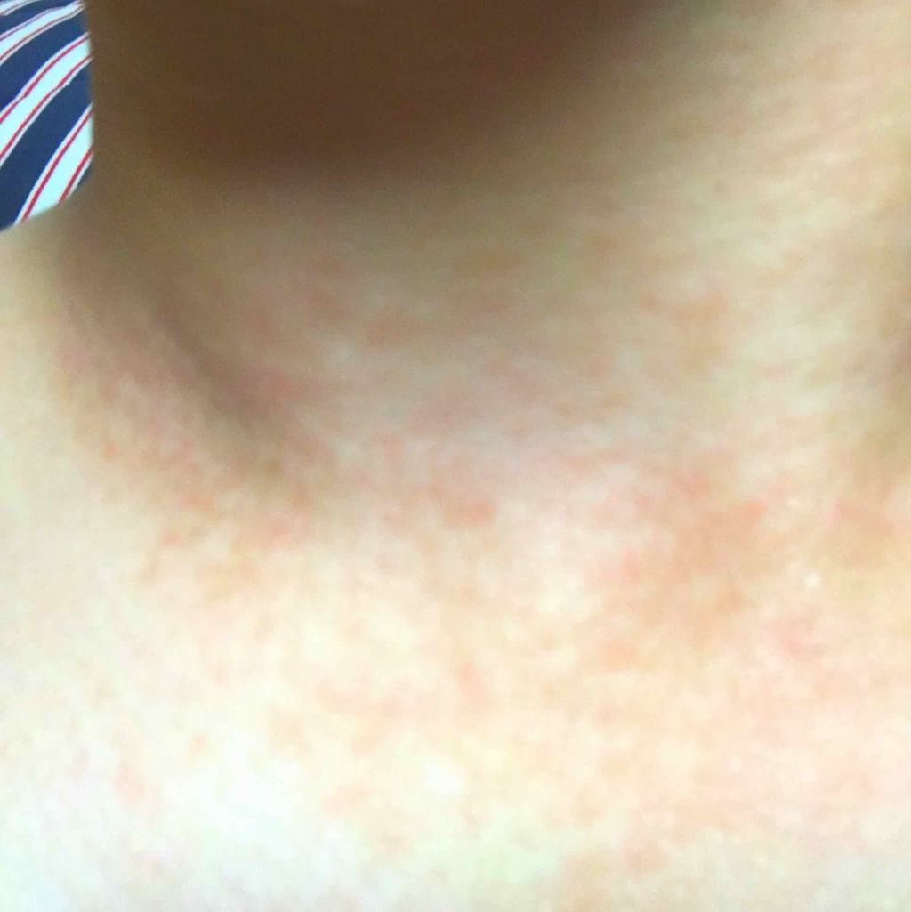 ジョンソン ベビーパウダー/ジョンソンベビー/ボディパウダーを使ったクチコミ(2枚目)