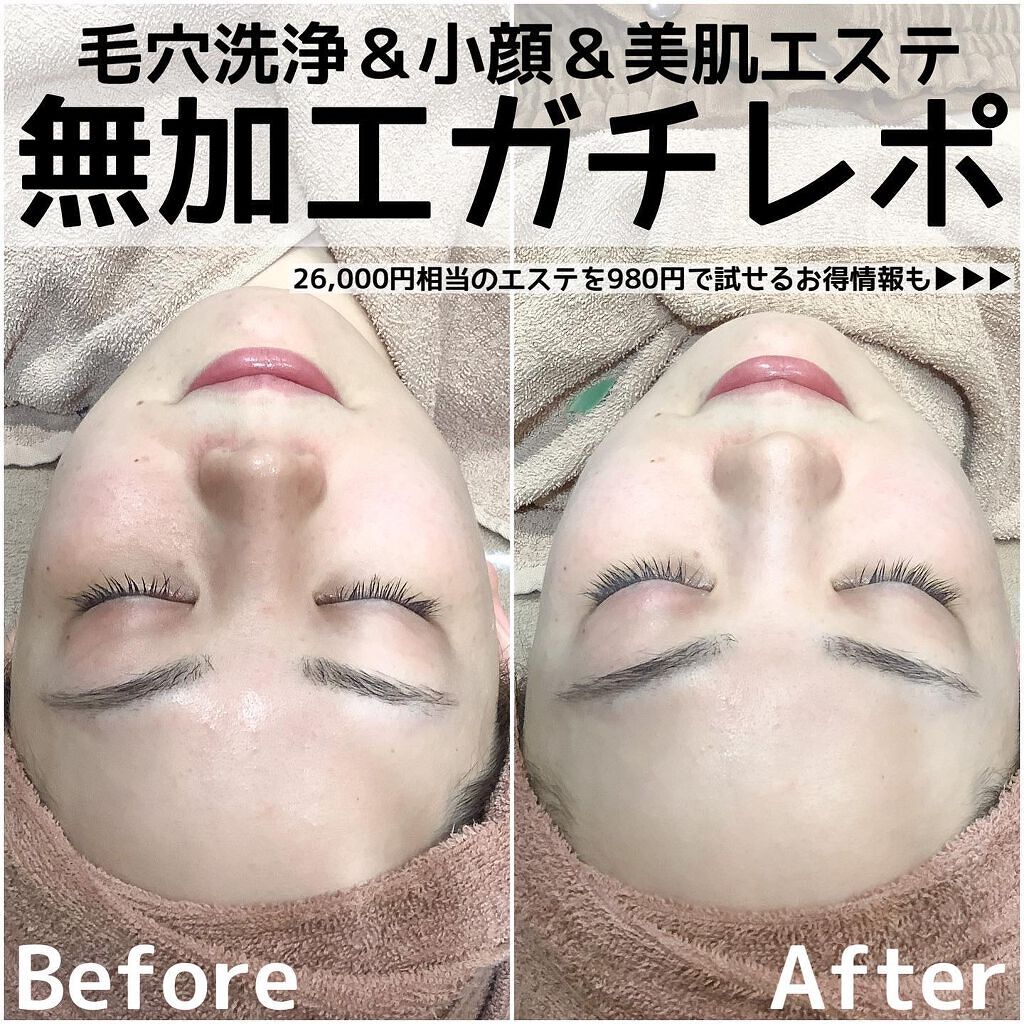 Riho | 集英社MAQUIAエキスパート on LIPS 「自分へのご褒美に❤️今回は珍しくエステレポ!✨産後、ゆっくり自..」(1枚目)