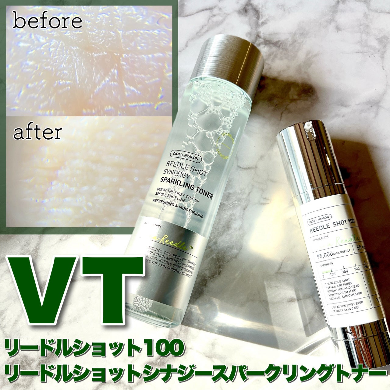 リードルショット100/VT/美容液を使ったクチコミ(1枚目)