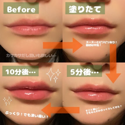 リードルS リッププランパーエキスパート/VT/リッププランパーを使ったクチコミ(3枚目)