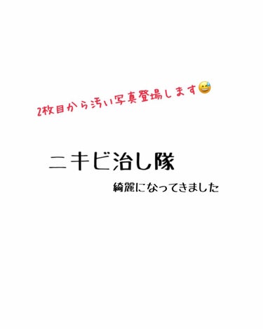 バイオイル/バイオイル/フェイスオイルを使ったクチコミ（1枚目）