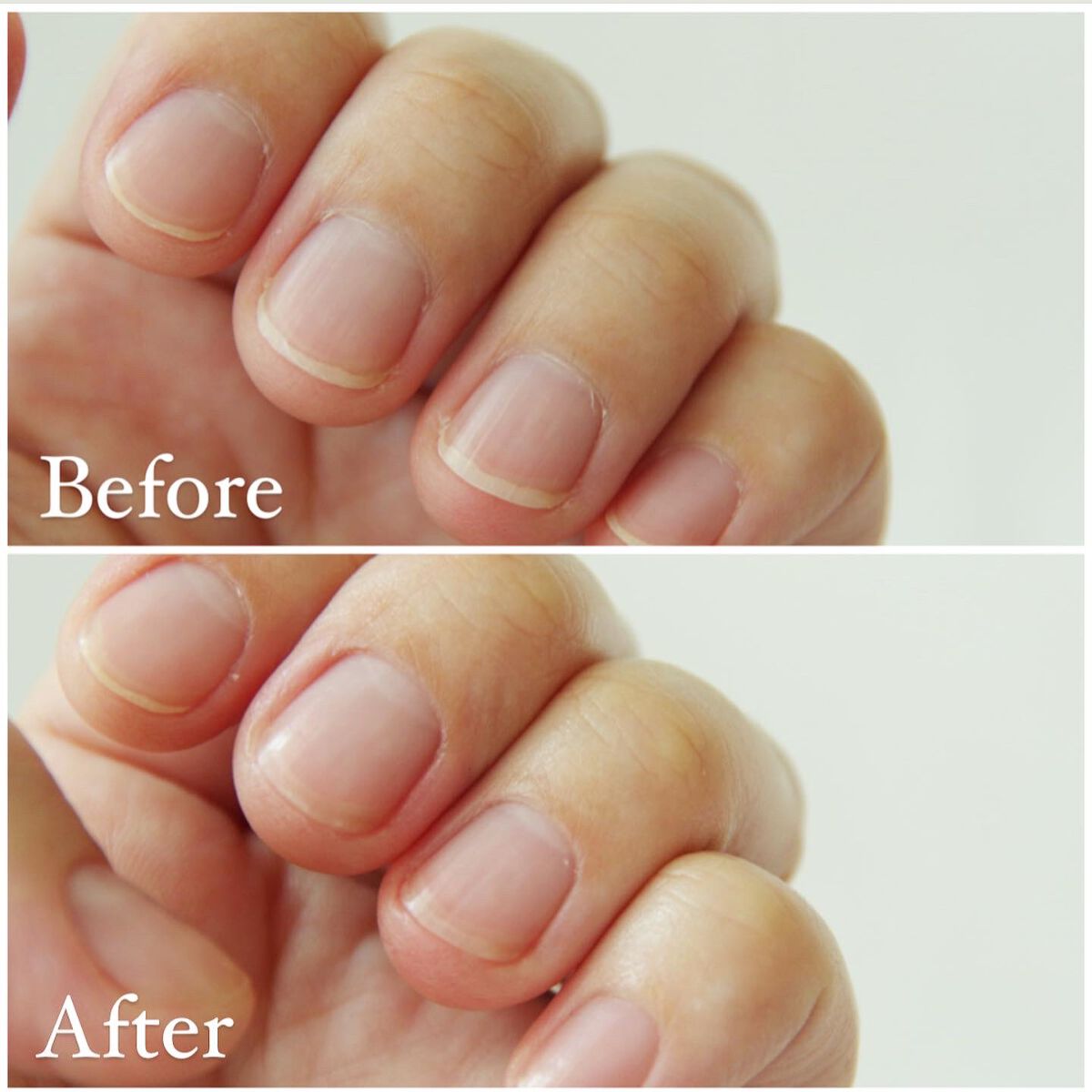 キューティクルペン/enieni /ネイルオイル・トリートメントを使ったクチコミ(2枚目)