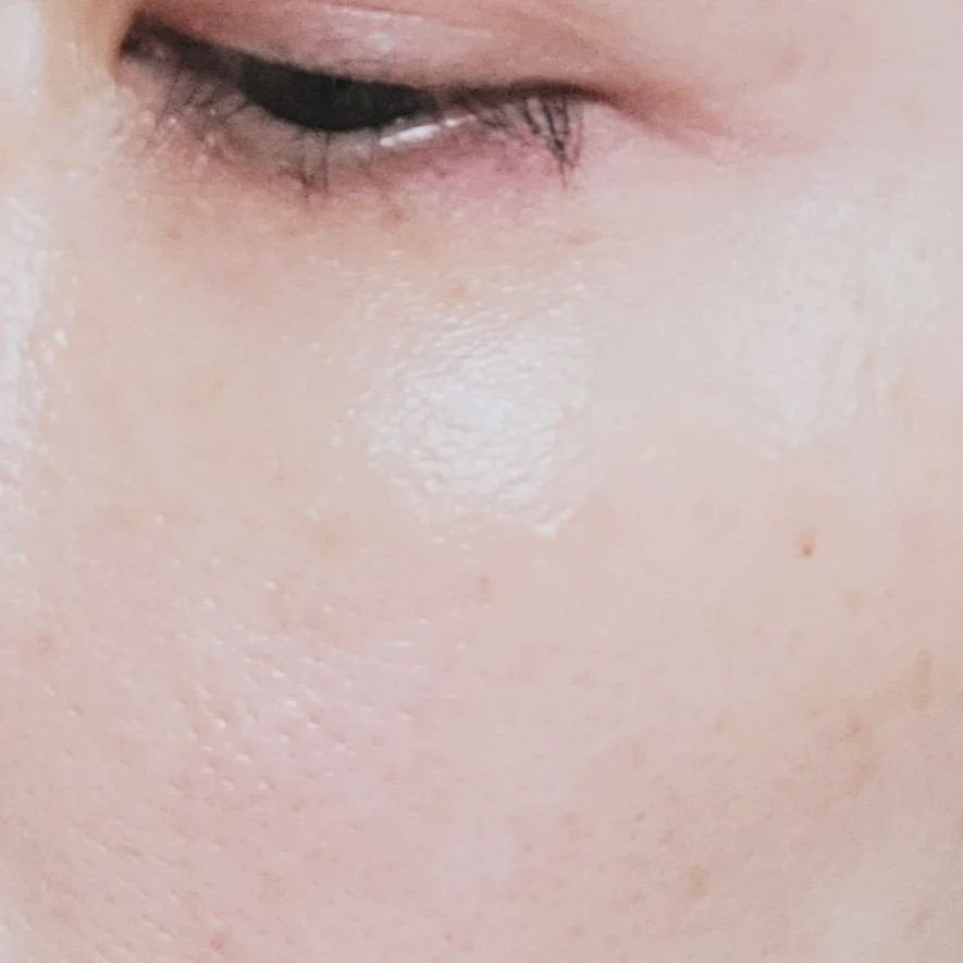 リンクルショット メディカル セラム N/リンクルショット/アイケア・アイクリームを使ったクチコミ(9枚目)