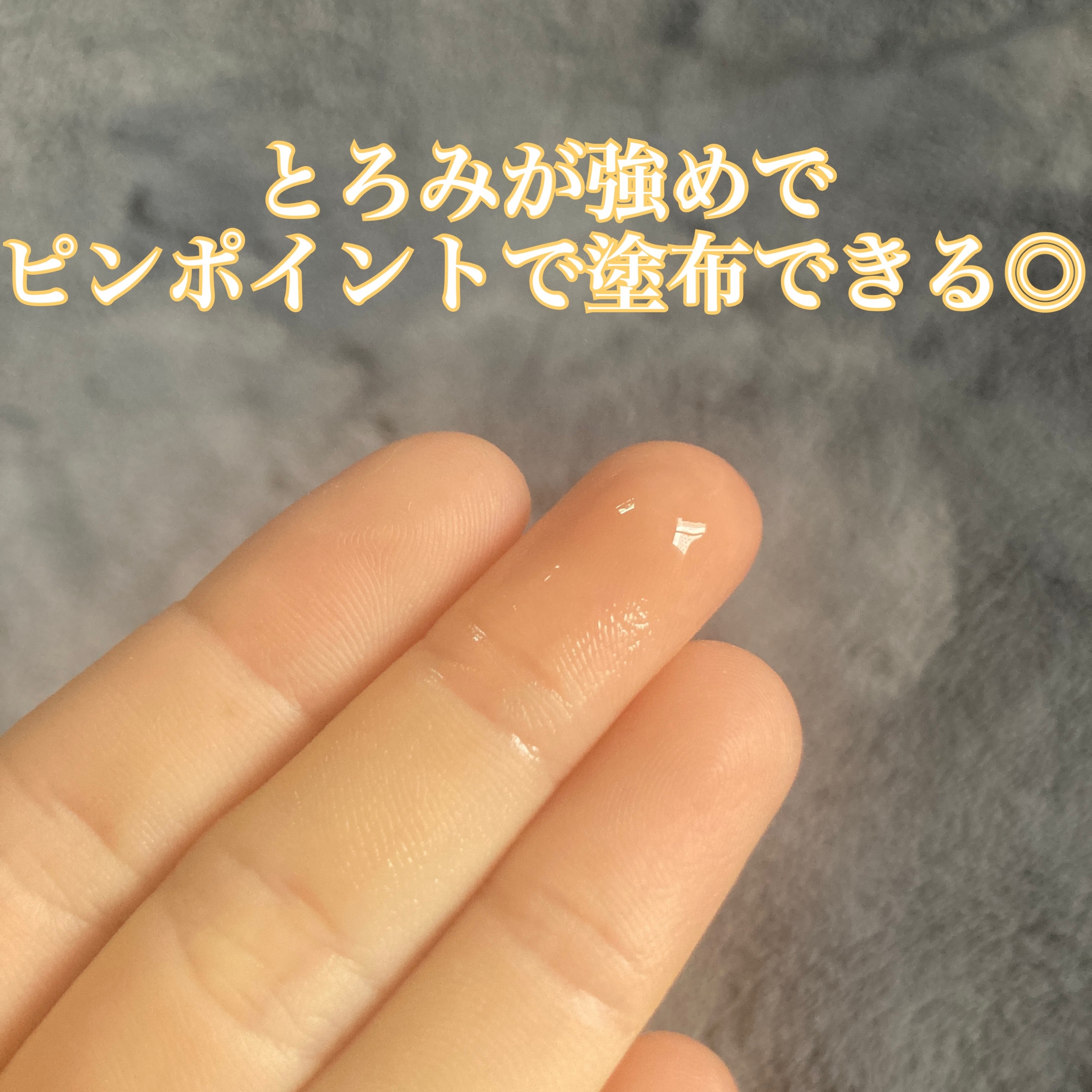 モイスチュアマイルドホワイトリペアエッセンス C100/モイスチュアマイルド ホワイト/美容液を使ったクチコミ（2枚目）