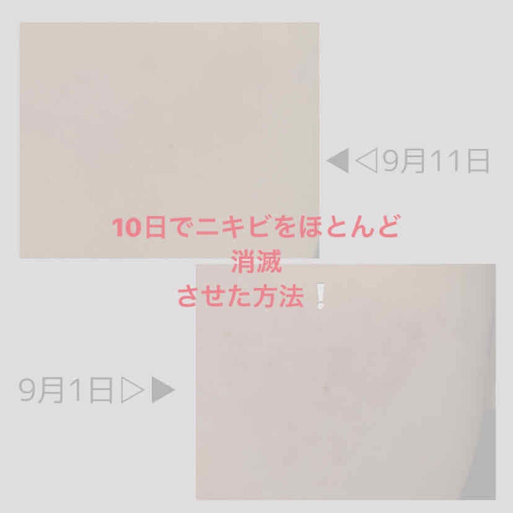 ハトムギ保湿ジェル(ナチュリエ スキンコンディショニングジェル)/ナチュリエ/美容液を使ったクチコミ(1枚目)