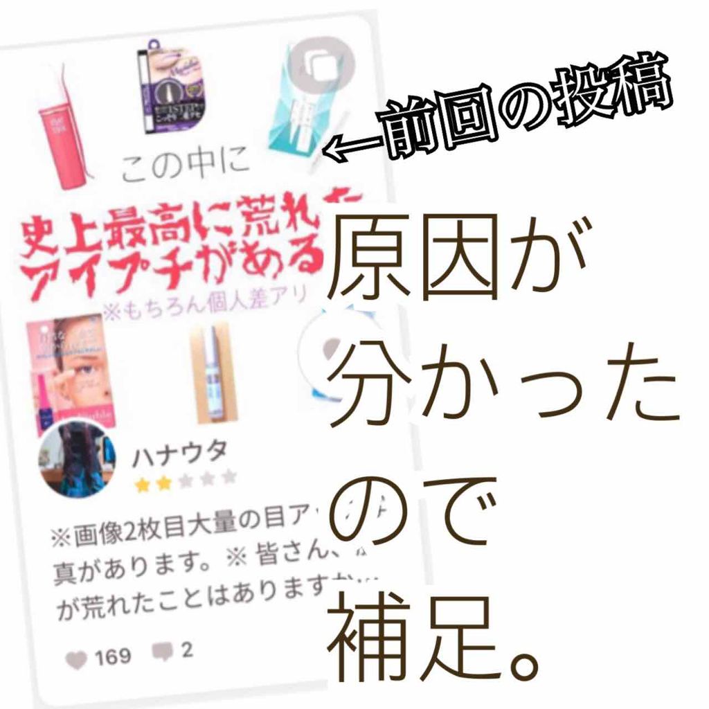 アイトーク/アイトーク/二重まぶた用アイテムを使ったクチコミ(1枚目)