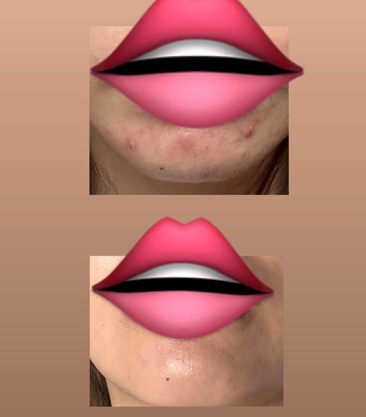 ミシャ ビタシープラス 美容液【日本処方】/MISSHA/美容液を使ったクチコミ(2枚目)